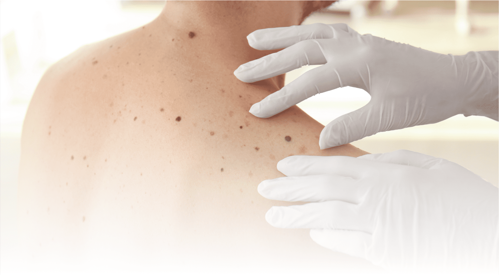 skin screening